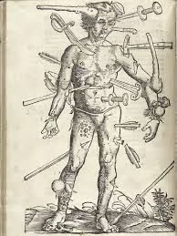 Wounded Man